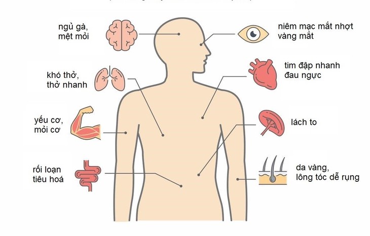 Nguyên nhân gây thiếu máu và điều trị - Ảnh 1.
