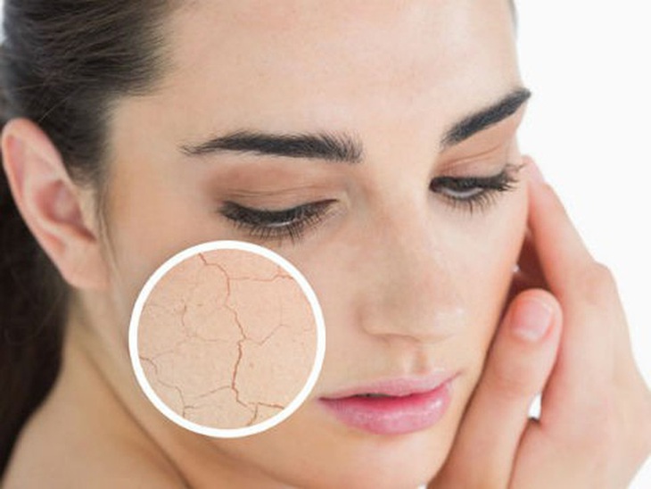 Một số loại rau củ dễ kiếm giúp dưỡng da trẻ đẹp từ bên trong - Ảnh 2.