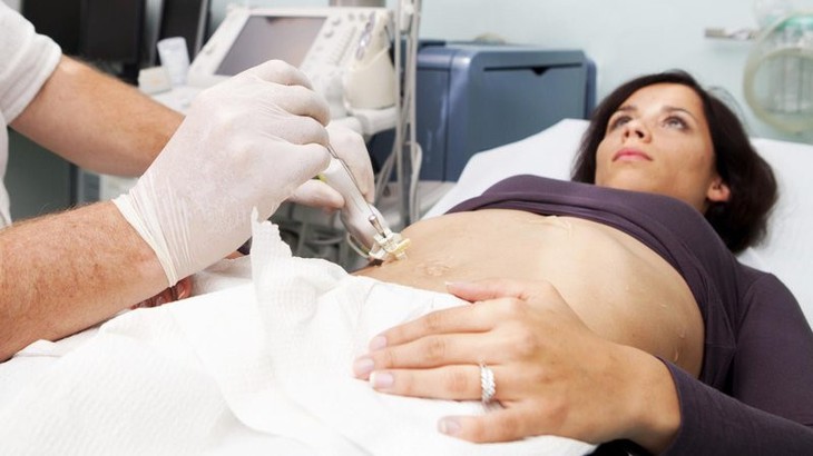 Chảy máu đường mật có thể nguy hiểm đến tính mạng - Ảnh 2.
