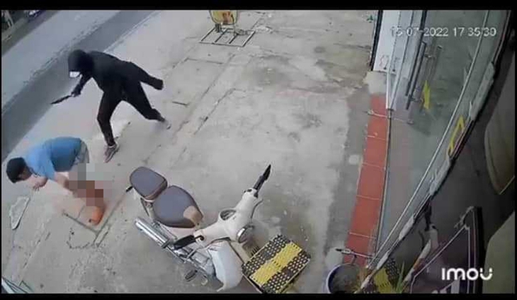 Đang đi trên đường, người đàn ông bị chém lìa chân ở Hà Nội - Ảnh 1. Đang đi trên đường, người đàn ông bị chém lìa chân ở Hà Nội - Ảnh 1.