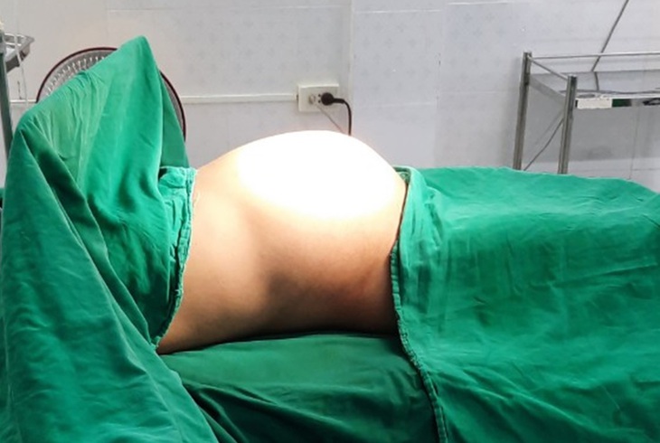 Cắt khối u buồng trứng khổng lồ nặng 10kg giải thoát cho cô gái trẻ
- Ảnh 1. Cắt khối u buồng trứng khổng lồ nặng 10kg giải thoát cho cô gái trẻ
- Ảnh 1.