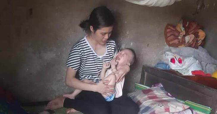 Sự sống mong manh của bé trai 2 tuổi bị não úng thủy, bố bỏ đi từ khi em mới lọt lòng