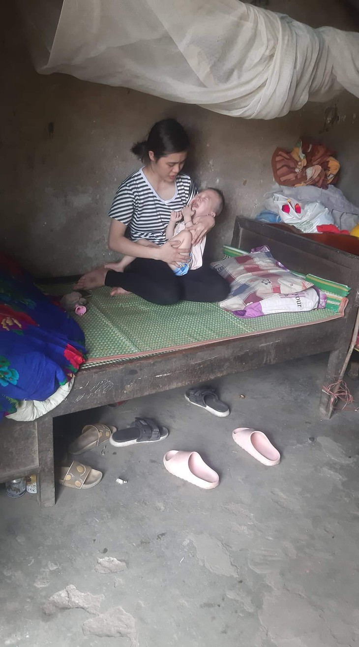 MS 771: Sự sống mong mong của bé trai 2 tuổi, bố bỏ đi từ khi lọt lòng bị não úng thủy - Ảnh 1. MS 771: Sự sống mong mong của bé trai 2 tuổi, bố bỏ đi từ khi lọt lòng bị não úng thủy - Ảnh 1.