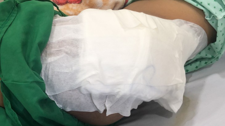Hậu quả khó lường từ đắp thuốc nam, thuốc lá không rõ nguồn gốc - Ảnh 2. Hậu quả khó lường từ đắp thuốc nam, thuốc lá không rõ nguồn gốc - Ảnh 2.