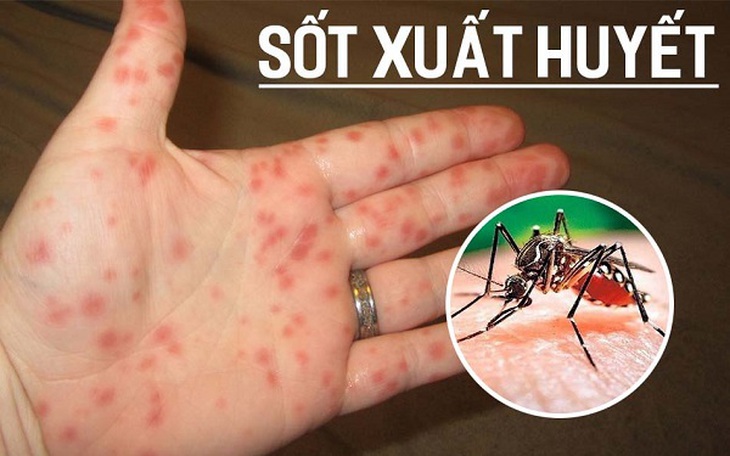 Dịch sốt xuất huyết phức tạp, Thủ tướng ra Công điện tăng cường các biện pháp phòng, chống