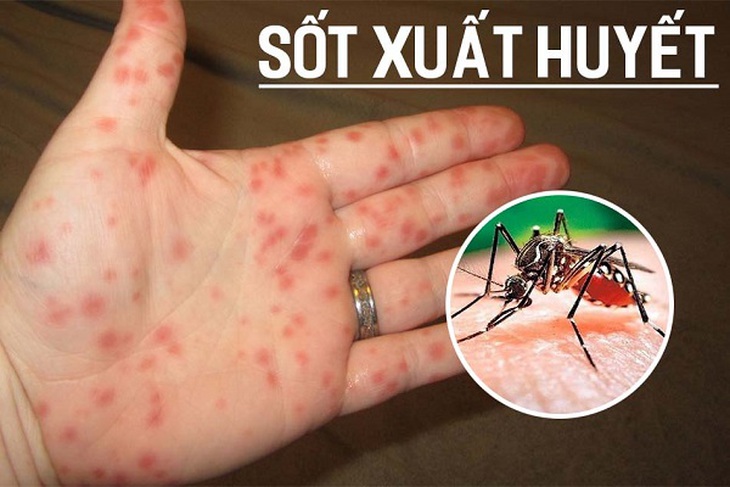 Dịch sốt xuất huyết phức tạp, Thủ tướng ra Công điện tăng cường các biện pháp phòng, chống - Ảnh 2.