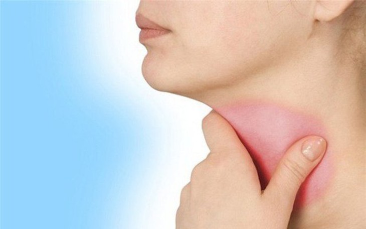 4 bài thuốc chữa viêm họng