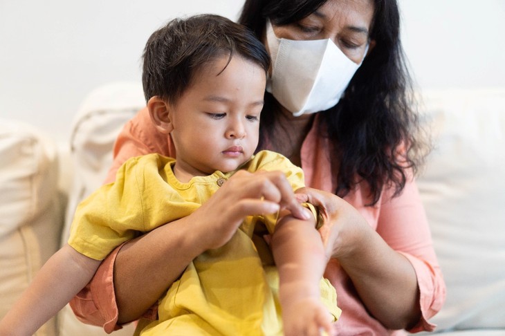 Những lưu ý quan trọng khi sử dụng paracetamol trong điều trị sốt xuất huyết - Ảnh 2. Những lưu ý quan trọng khi sử dụng paracetamol trong điều trị sốt xuất huyết - Ảnh 2.