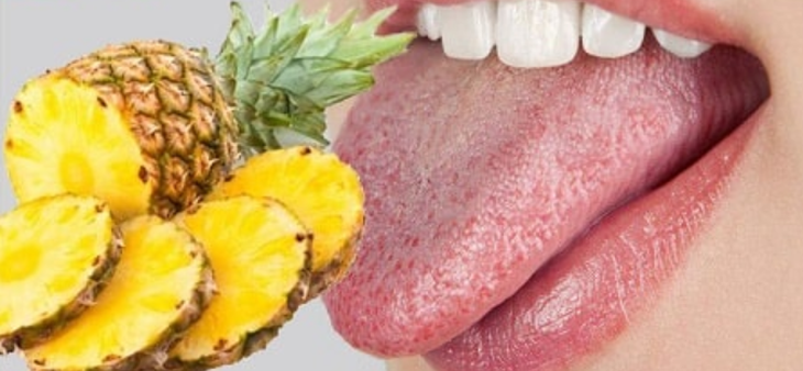 Ăn dứa bị rát lưỡi có sao không? - Ảnh 2.