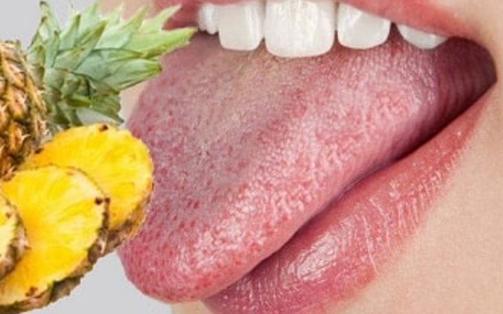  Ăn dứa bị rát lưỡi có sao không? 