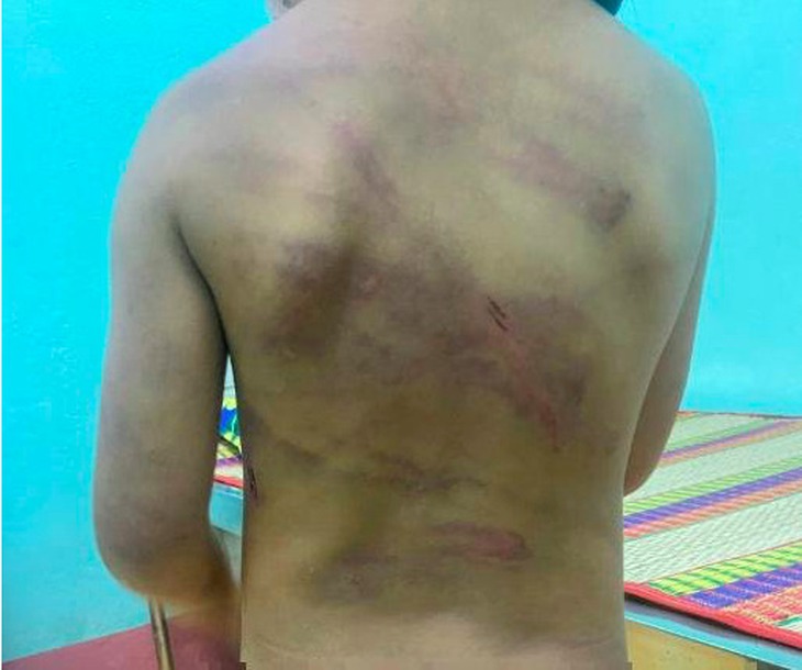 Liên tiếp xuất hiện các vụ bạo hành trẻ em trong thời gian gần đây - Ảnh 1. Liên tiếp xuất hiện các vụ bạo hành trẻ em trong thời gian gần đây - Ảnh 1.