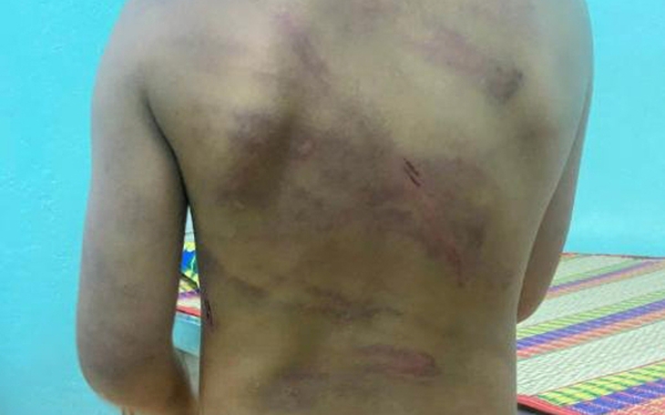 Cơ quan chức năng vào cuộc xác minh vụ bé gái 7 tuổi nghi bị bạo hành 