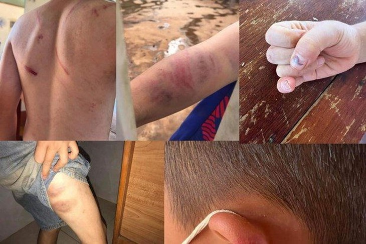 Liên tiếp xuất hiện các vụ bạo hành trẻ em trong thời gian gần đây - Ảnh 2. Liên tiếp xuất hiện các vụ bạo hành trẻ em trong thời gian gần đây - Ảnh 2.