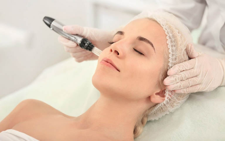 Lưu ý quan trọng khi trị nám da bằng laser