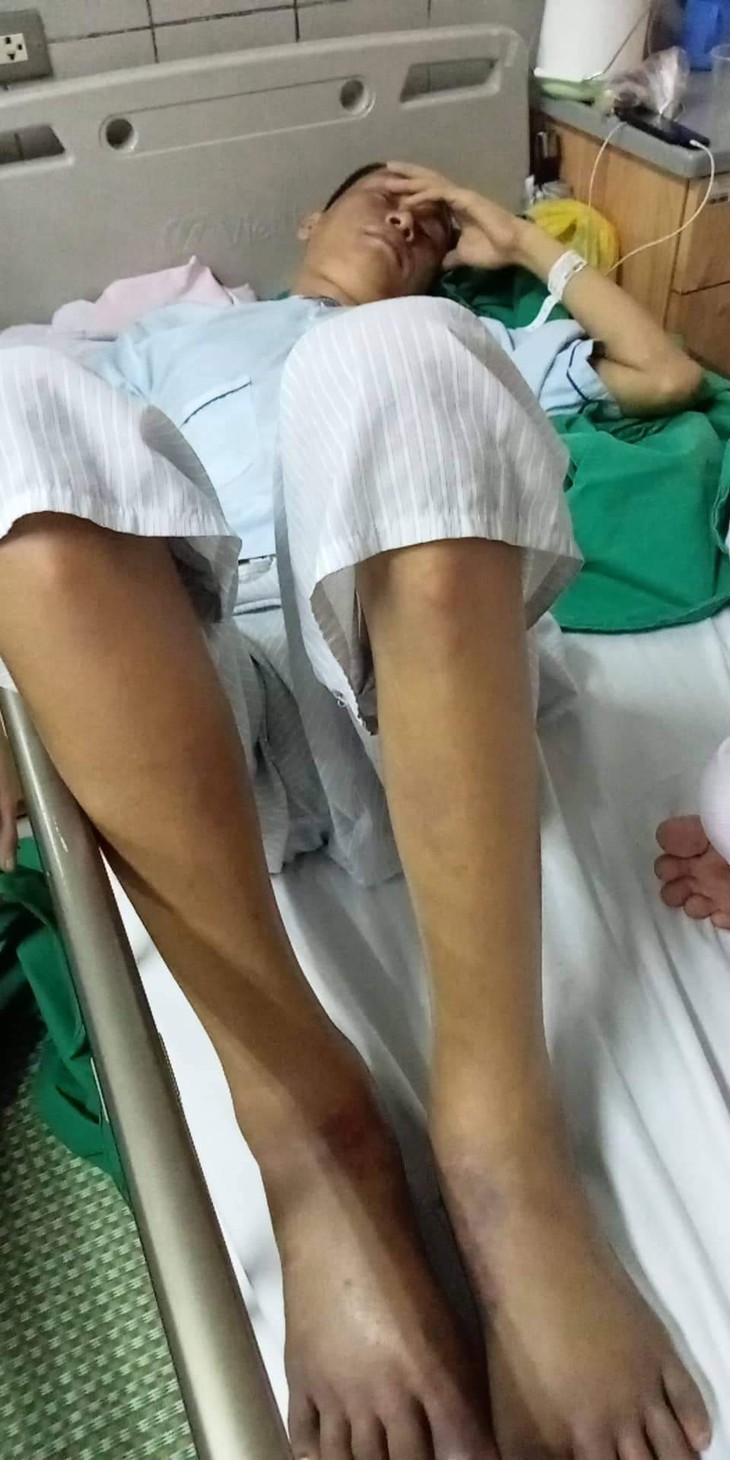 MS 773: Người vợ nghèo mong có được 70 triệu đồng để cứu lấy chân của người chồng - Ảnh 2. MS 773: Người vợ nghèo mong có được 70 triệu đồng để cứu lấy chân của người chồng - Ảnh 2.