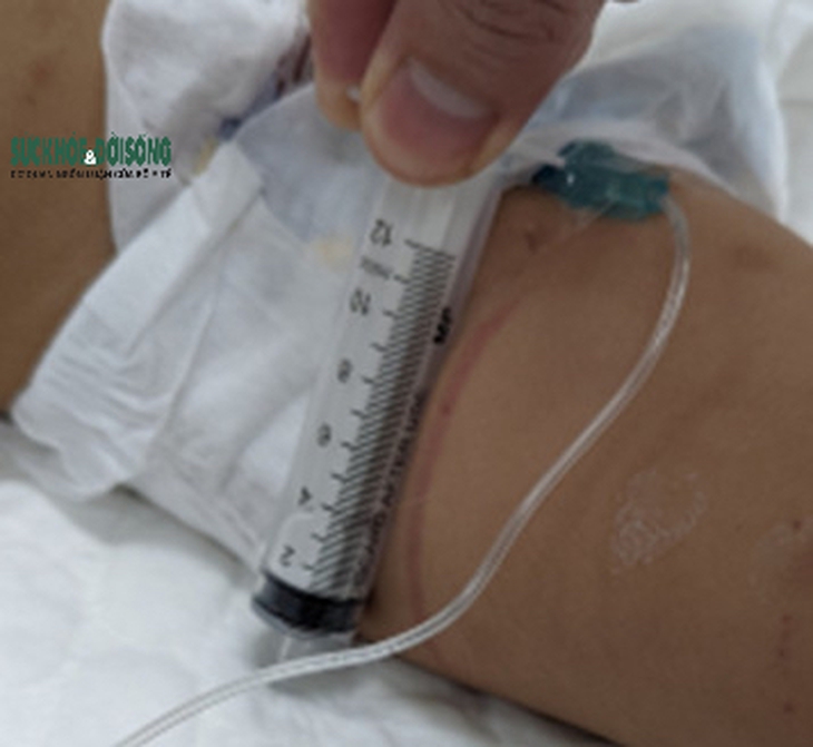 Cập nhật mới nhất sức khoẻ của bé gái 18 tháng nghi bị 2 vợ chồng ở Hà Nội bạo hành
 - Ảnh 4.