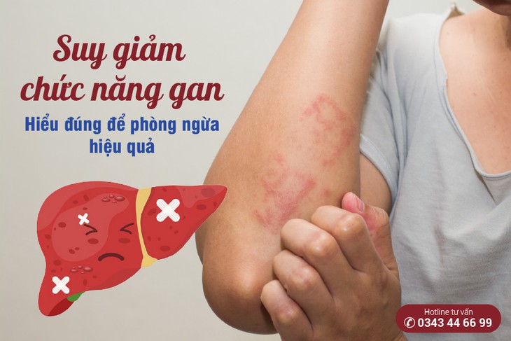 Suy giảm chức năng gan: Hiểu đúng để phòng ngừa hiệu quả - Ảnh 1. Suy giảm chức năng gan: Hiểu đúng để phòng ngừa hiệu quả - Ảnh 1.