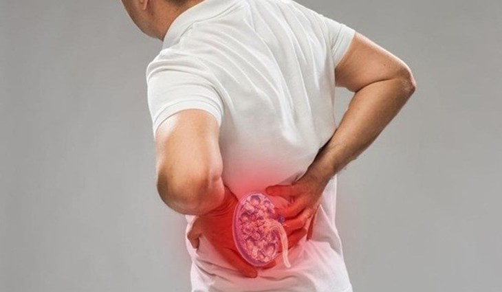 Cảnh báo tình trạng "giữ sỏi" lâu năm - Ảnh 1. Cảnh báo tình trạng "giữ sỏi" lâu năm - Ảnh 1.