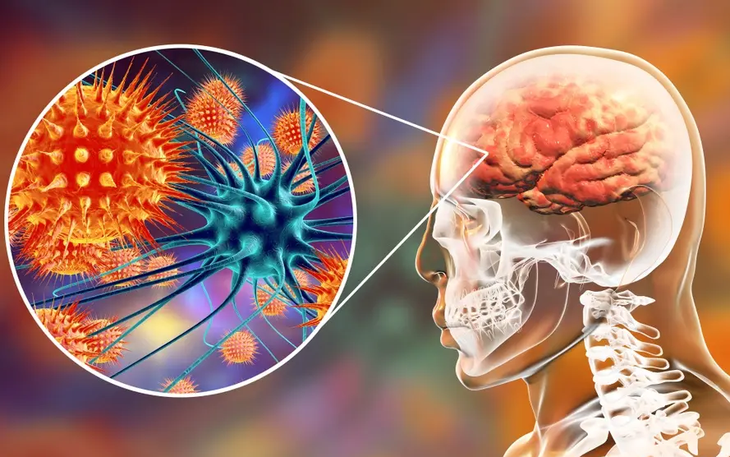 Cảnh giác với loài dơi 'cáo bay' ăn quả - Vật chủ truyền virus Hendra và Nipah nguy hiểm- Ảnh 5.