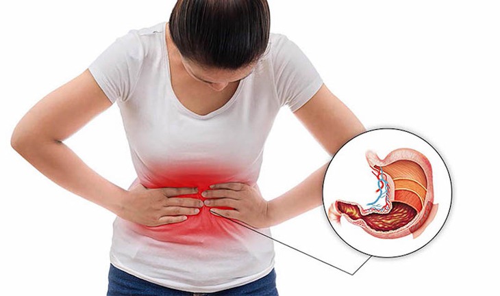 Ăn gì để dạ dày "hiền"? - Ảnh 2.