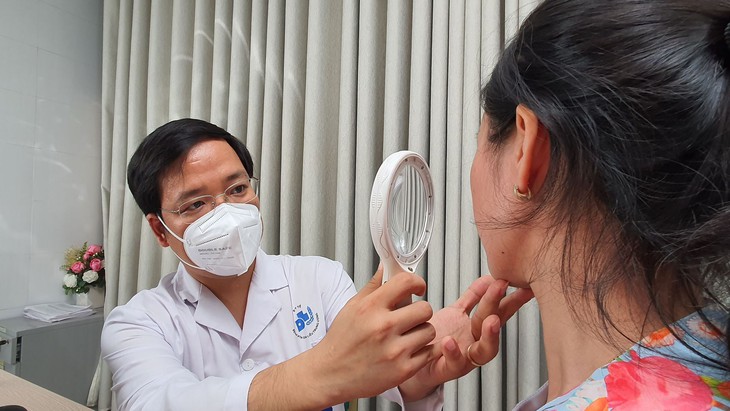 Nhiễm độc corticoid, da 'mỏng tang' sau khi bôi kem trộn chữa nám - Ảnh 1.