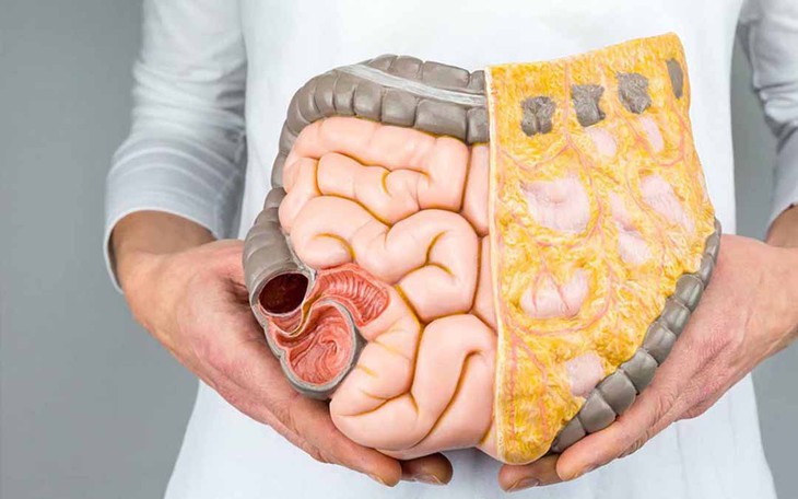 Ăn gì để dạ dày 'hiền'?