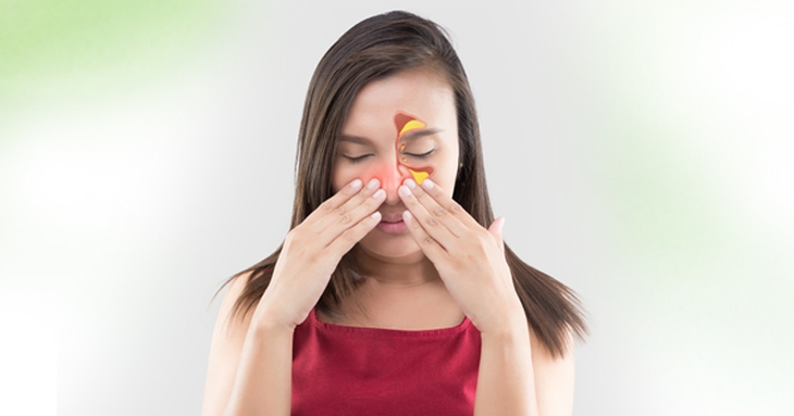 Điều trị viêm xoang: Đừng vội dùng thuốc kháng sinh - Ảnh 1. Điều trị viêm xoang: Đừng vội dùng thuốc kháng sinh - Ảnh 1.