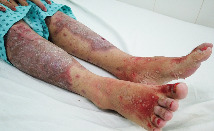 Suýt chết vì dùng thực phẩm chức năng làm đẹp da, thải độc tố  - Ảnh 1.