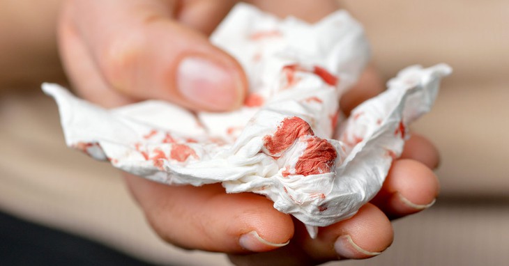 13 triệu chứng "cờ đỏ" của bệnh ung thư mà bạn nhất định phải kiểm tra - Ảnh 5.