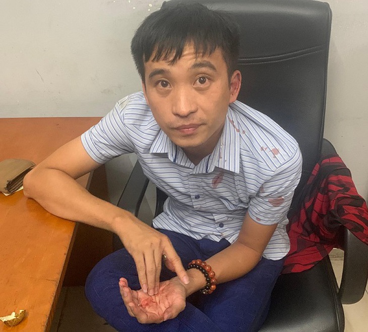 Lái xe gây tai nạn tại cây xăng đường Láng vi phạm nồng độ cồn gấp đôi mức kịch khung - Ảnh 2. Lái xe gây tai nạn tại cây xăng đường Láng vi phạm nồng độ cồn gấp đôi mức kịch khung - Ảnh 2.