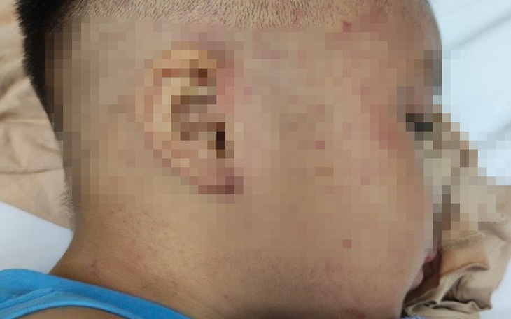 Diễn biến mới nhất vụ bé trai 3 tuổi nghi bị bạo hành, nhốt trong tủ cấp đông