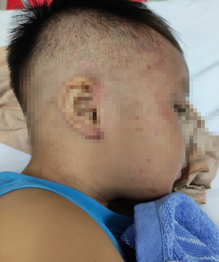 Nóng: Cứu thành công bé trai 3,5 tuổi ở Hà Nam nghi bị bạo hành, nhốt trong tủ cấp đông - Ảnh 1. Nóng: Cứu thành công bé trai 3,5 tuổi ở Hà Nam nghi bị bạo hành, nhốt trong tủ cấp đông - Ảnh 1.