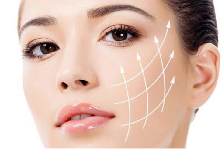 Ai không nên căng da mặt bằng chỉ? - Ảnh 2.
