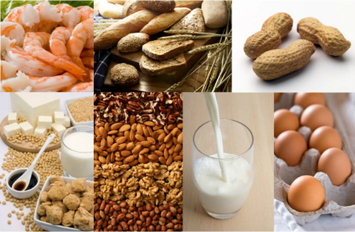 Từ vụ sốc phản vệ sau ăn cá thu, khuyến cáo những loại thực phẩm dễ gây dị ứng, cần thận trọng khi ăn - Ảnh 4. Từ vụ sốc phản vệ sau ăn cá thu, khuyến cáo những loại thực phẩm dễ gây dị ứng, cần thận trọng khi ăn - Ảnh 4.