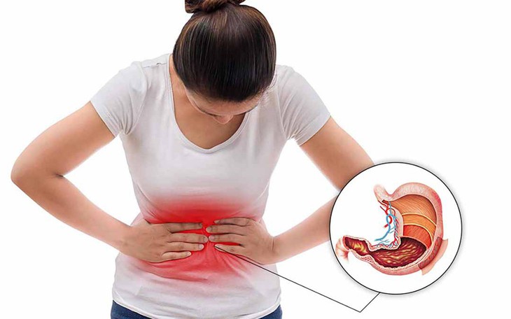 Người mắc bệnh viêm loét dạ dày nên kiêng ăn gì để ngừa cơn đau dữ dội?