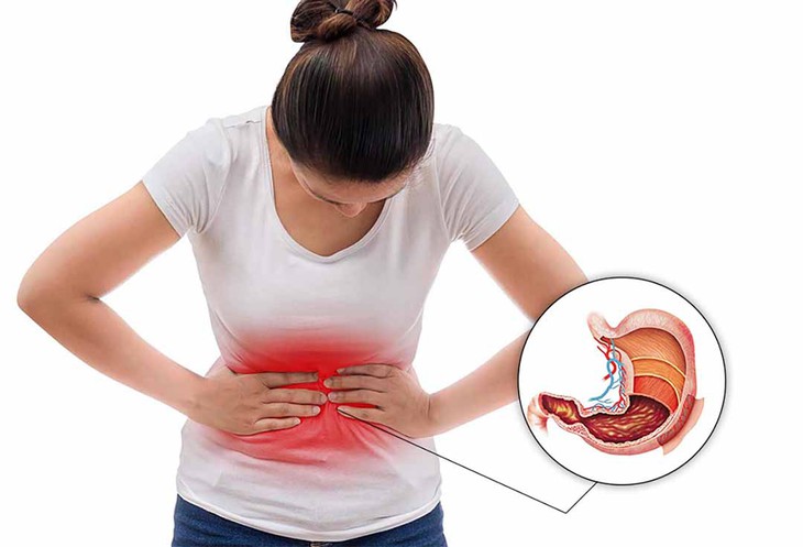 Người mắc bệnh viêm loét dạ dày nên kiêng ăn gì để ngừa cơn đau dữ dội? - Ảnh 2.