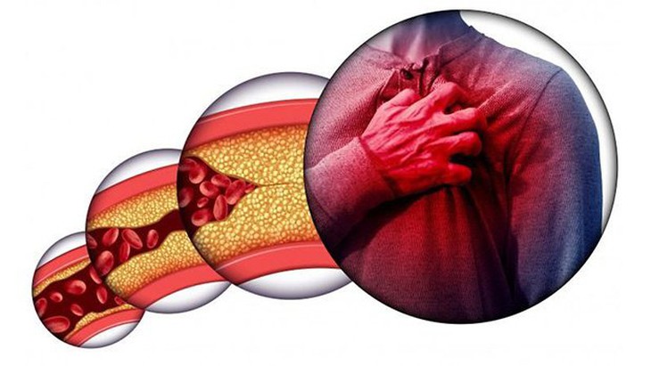 Cholesterol là một chất béo có ở màng tế bào của tất cả các mô tổ chức trong cơ thể và được vận chuyển trong huyết tương của con người.