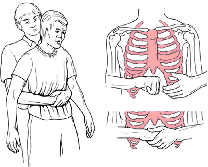 Hạt mít mắc kẹt trong dạ dày nam thanh niên - Ảnh 1.