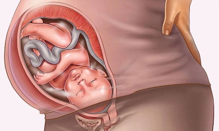 Lựa chọn thuốc điều trị nấm âm đạo cho phụ nữ mang thai - Ảnh 1.