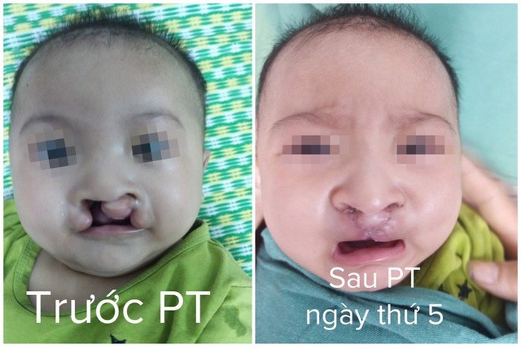 Bệnh viện Sản nhi Nghệ An – nơi hàn gắn những nụ cười trên môi trẻ thơ - Ảnh 1. Bệnh viện Sản nhi Nghệ An – nơi hàn gắn những nụ cười trên môi trẻ thơ - Ảnh 1.