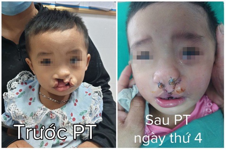 Bệnh viện Sản nhi Nghệ An – nơi hàn gắn những nụ cười trên môi trẻ thơ - Ảnh 2. Bệnh viện Sản nhi Nghệ An – nơi hàn gắn những nụ cười trên môi trẻ thơ - Ảnh 2.