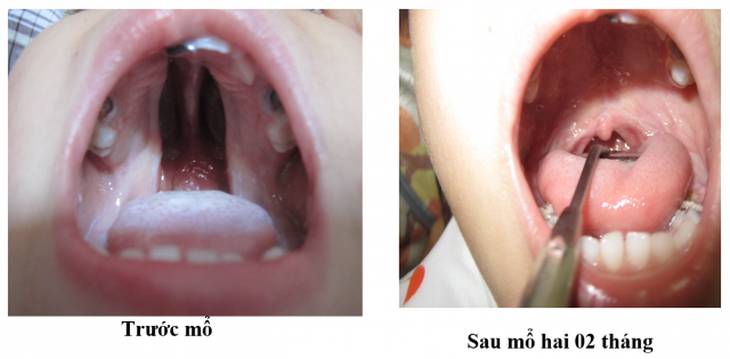 Bệnh viện Sản nhi Nghệ An – nơi hàn gắn những nụ cười trên môi trẻ thơ - Ảnh 3. Bệnh viện Sản nhi Nghệ An – nơi hàn gắn những nụ cười trên môi trẻ thơ - Ảnh 3.