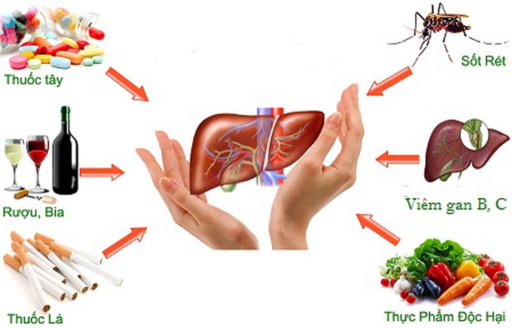 Suy gan cấp ở trẻ em do đâu? - Ảnh 4.