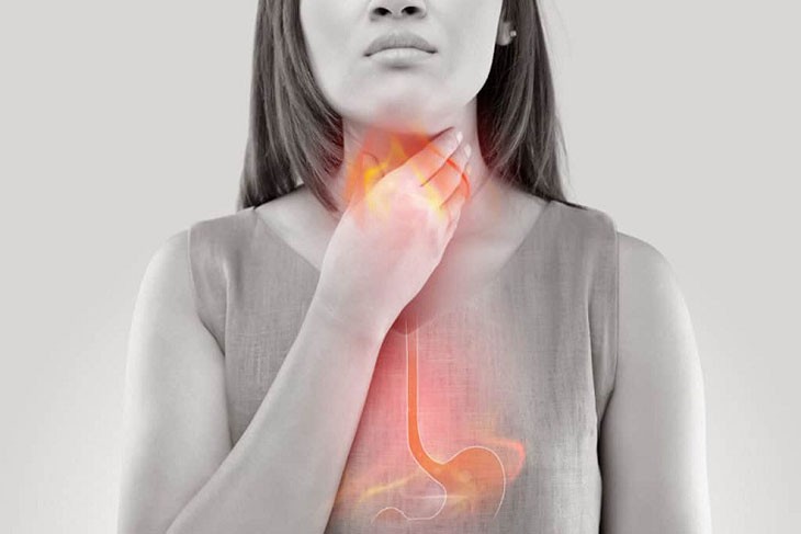 Trào ngược dạ dày thực quản tái phát nhiều lần phải làm sao? - Ảnh 2.