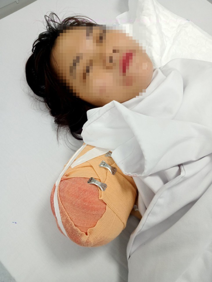 Gia cảnh đáng thương của người phụ nữ bị đứt lìa cánh tay trong vụ lật xe chở công nhân ở Bắc Giang - Ảnh 4. Gia cảnh đáng thương của người phụ nữ bị đứt lìa cánh tay trong vụ lật xe chở công nhân ở Bắc Giang - Ảnh 4.