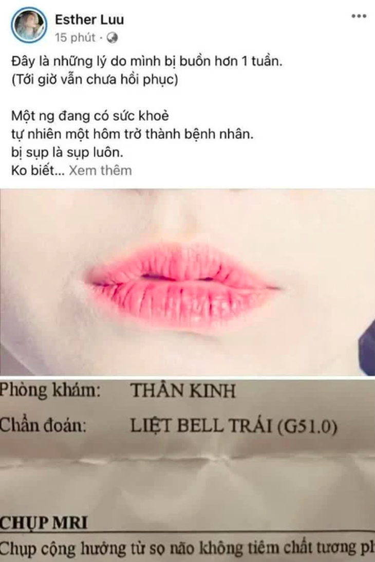- Ảnh 4.
