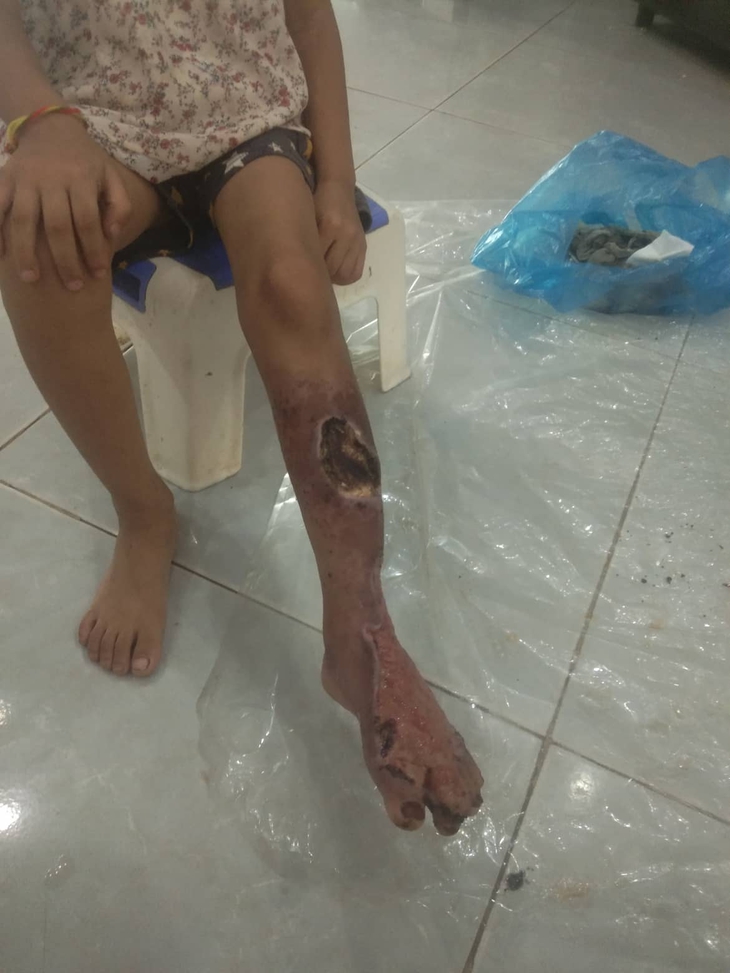 - Ảnh 3.