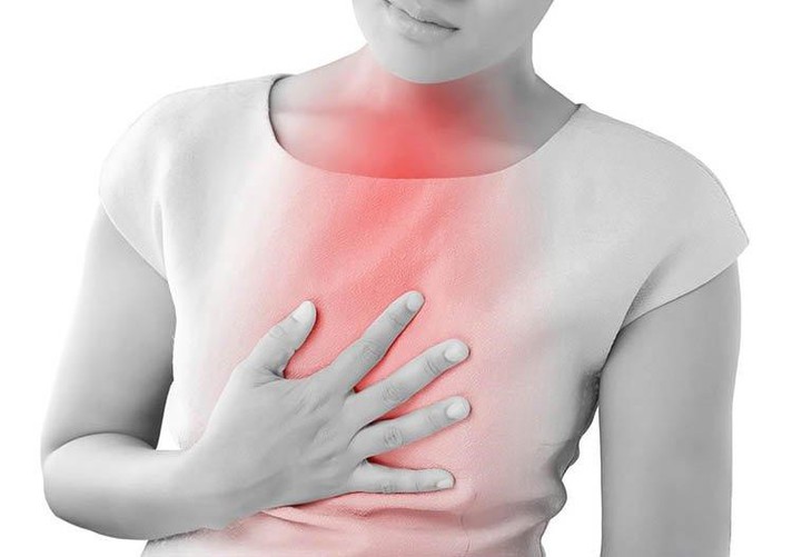Trào ngược dạ dày thực quản, triệu chứng, nguyên nhân và cách điều trị - Ảnh 2.