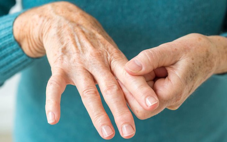 Thay đổi khuôn mặt như mũi to, trán to… cảnh giác với bệnh to đầu chi
