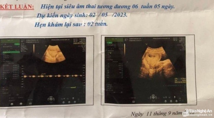 Nghi án bảo vệ 70 tuổi khiến nữ sinh lớp 6 có bầu - Ảnh 1. Nghi án bảo vệ 70 tuổi khiến nữ sinh lớp 6 có bầu - Ảnh 1.